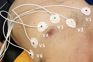 Figura 2: Colocación electrodos precordiales