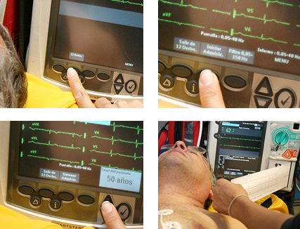 Figura 11: Pasos para realizar EKG 12