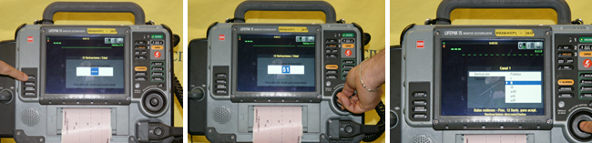 Figura 13. Botón selector EKG 12 derivaciones, selección de edad, señal DATOS RUIDOSOS