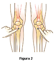 Figura 2