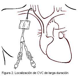 Figura 2