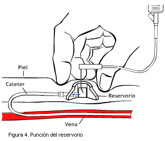 Figura 4